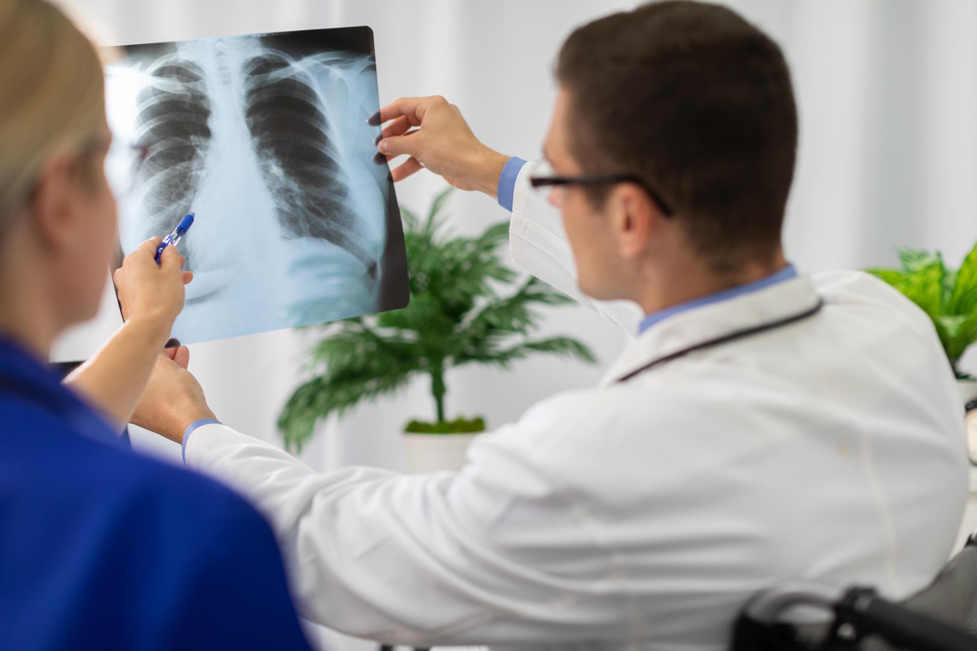 medecin pneumologue qui analyse une radio des poumons