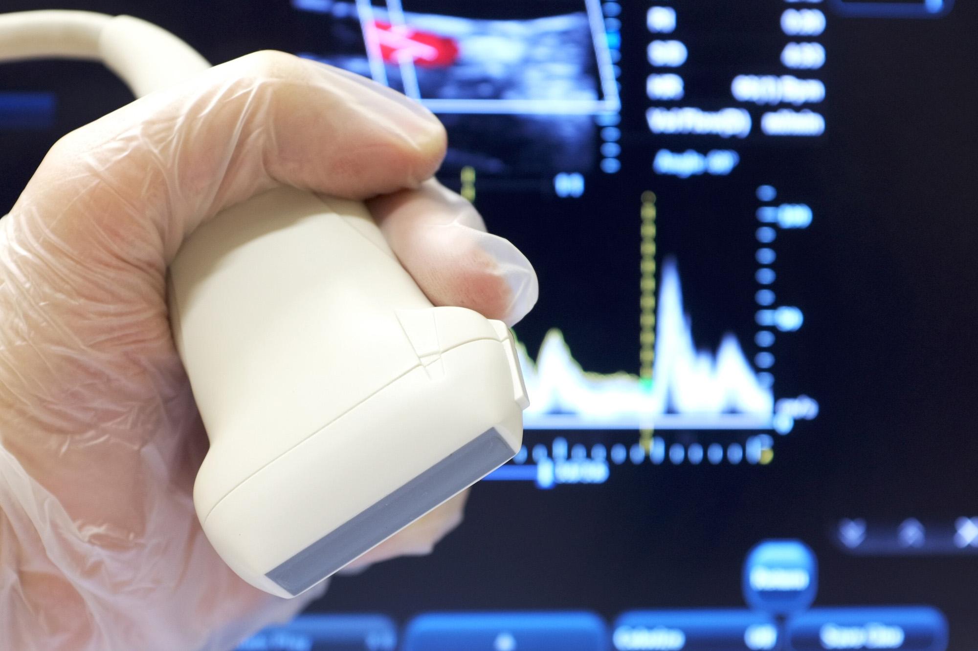 donnees d une echographie 